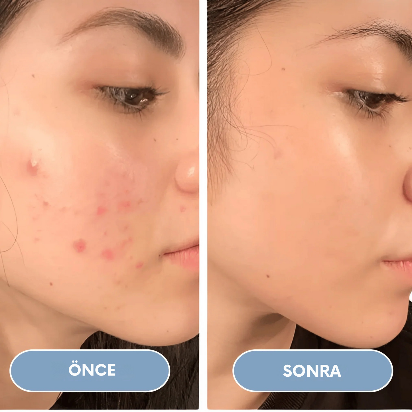 5 Fonksiyonlu Filtreli Jet Duş Başlığı